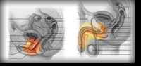 Uretrites Não Gonocócicas